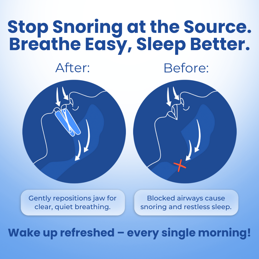 SnoreLess Guard’s Anti-Snore Mouth Guard+ by GetSnoreLessNight